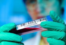 Czy warto robić ELISpota?