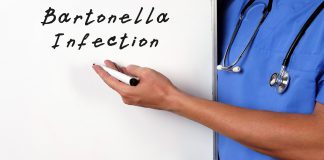 bartonella borelioza koinfekcje